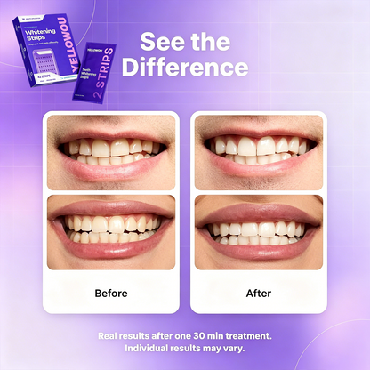 YELLOWOU Purple Teeth Whitening Strips 14 Treatments - Safe for Enamel - Non Sensitive Teeth Whitening - Whitening Without Any Harm - Pack of 28 Strips